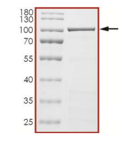 The purity of ADAR2L (ADARB1) was determined to be >85% by densitometry. 
Observed MW ~100 kDa
Calculated MW ~85 kDa.
